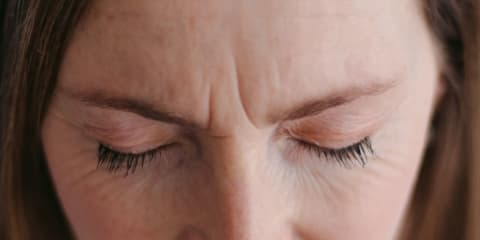 woman with forehead wrinkles and frown lines woman with forehead wrinkles and frown lines